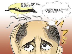 脱发有哪些治疗误区