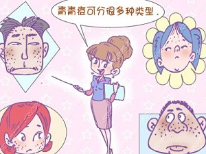 痤疮有哪些治疗误区